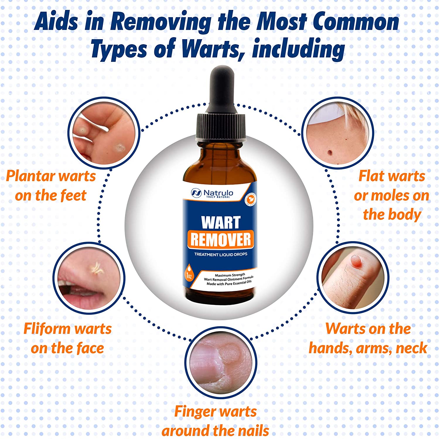 Plant Therapy No More Warts  Natural Wart Removal Essential Oils