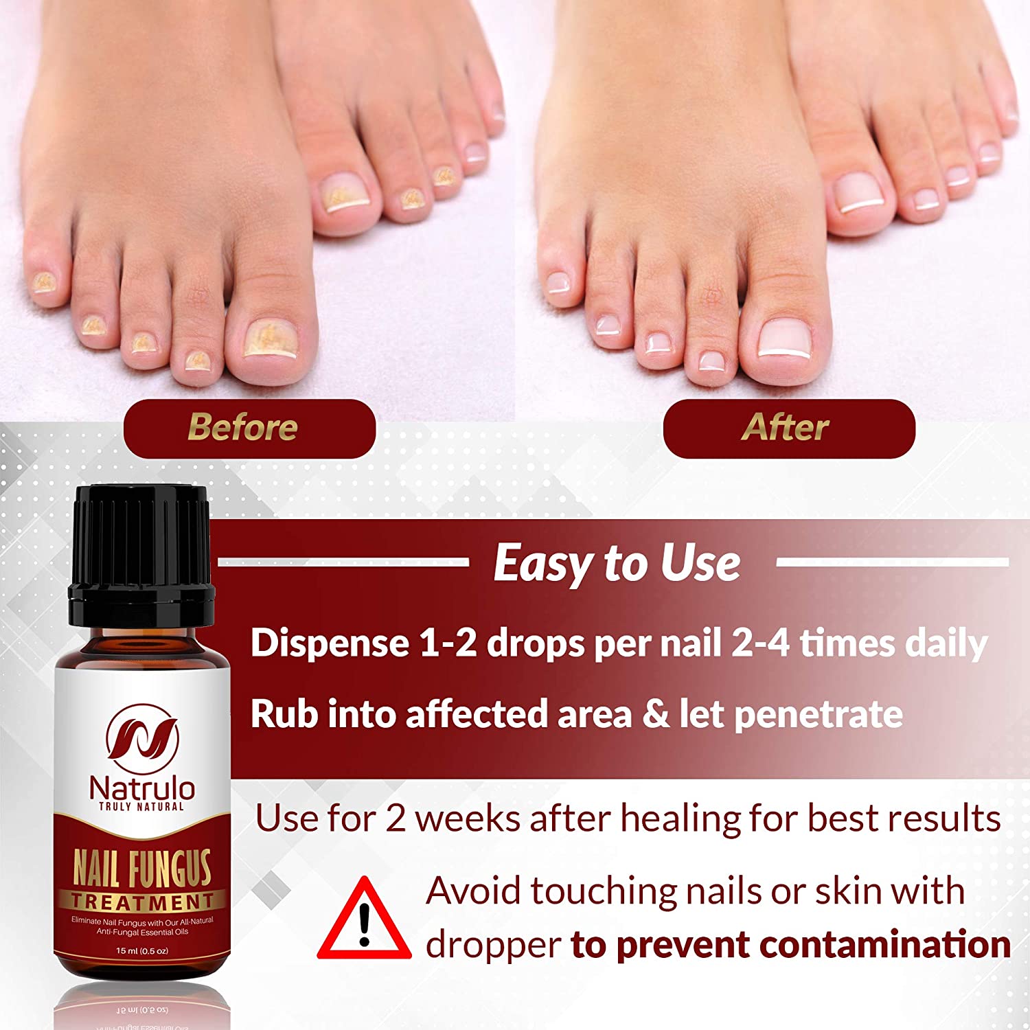Amazon.com : Toenail Fungus Treatment: Premium Tea Tree & Essential Oil  Blend - USA Clean Ingredients - No Fillers - No Harsh Chemicals - Max  Strength Formula for Damaged & Discolored Toe